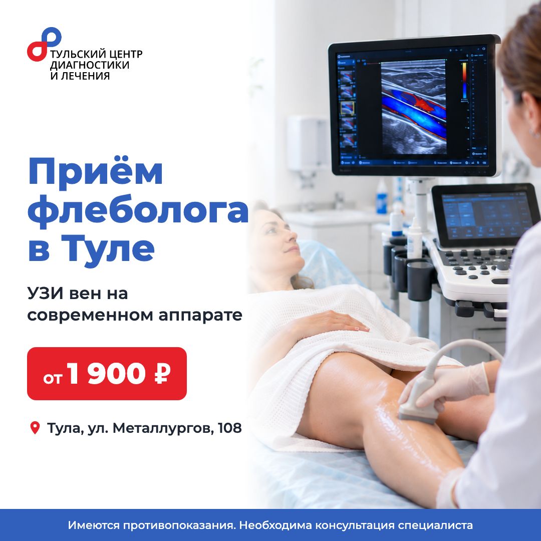 Креатив: УЗИ вен